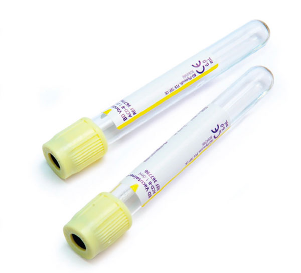 Zkumavky pro stanovení krevní skupiny