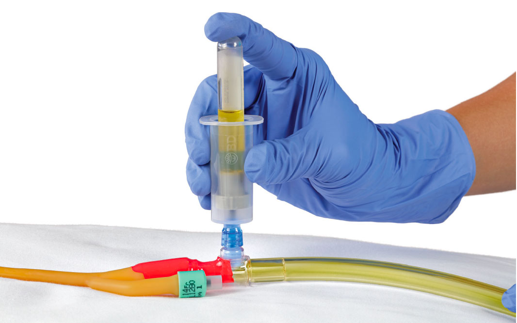 BD Vacutainer® systém pro odběr moči