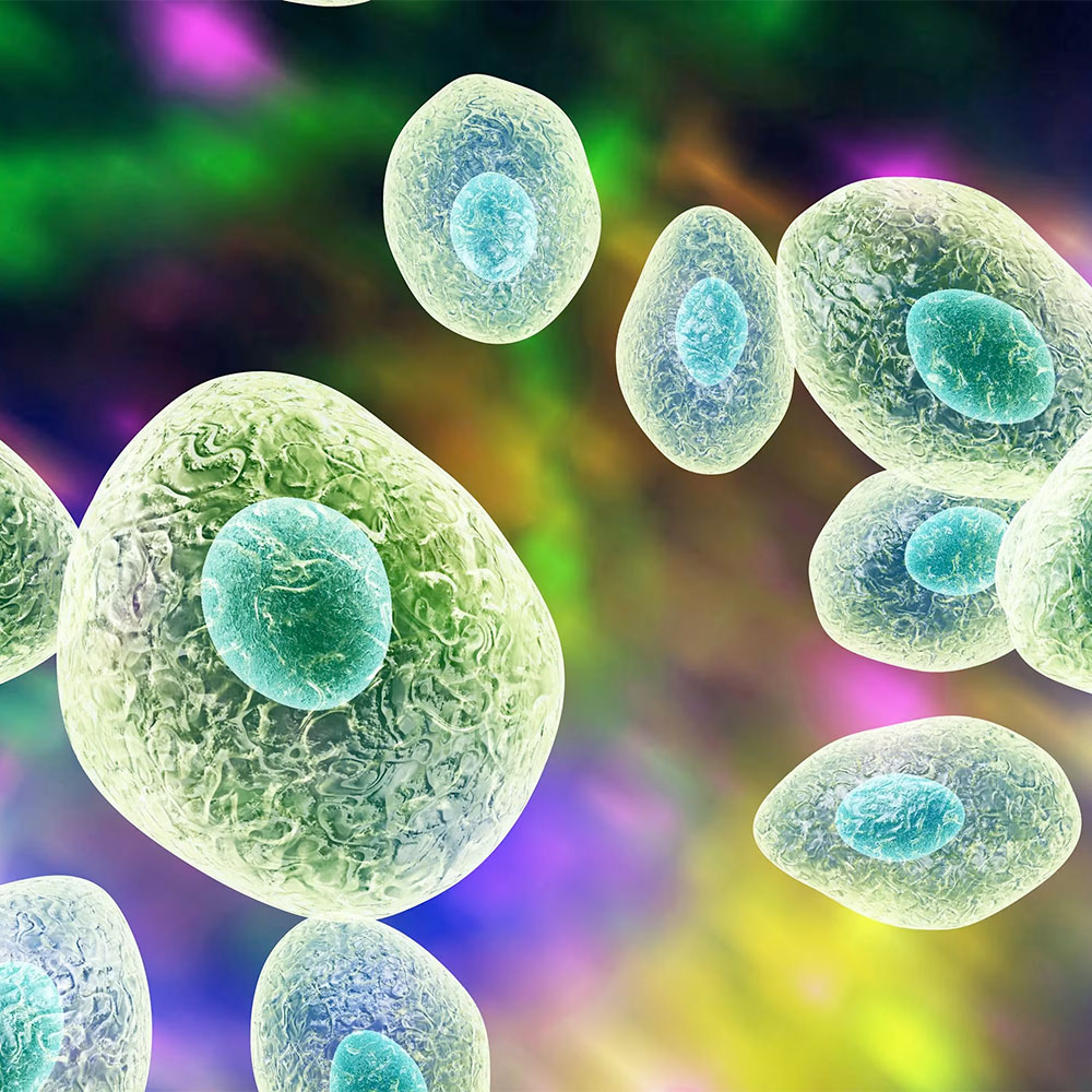 Pneumocystis jirovecii PCR